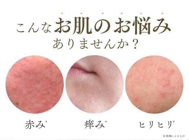 公式通販サイト】脂漏性敏感肌用クレチュールジュレローションEX