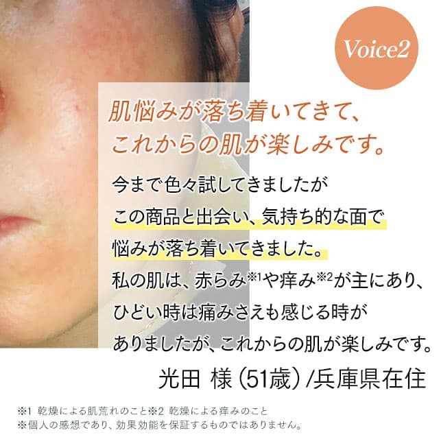 公式通販サイト】脂漏性敏感肌用クレチュールジュレローションEX
