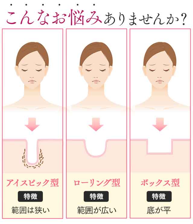 公式通販サイト「ベルクイーン」月面のようなボコボコ肌ケア美容液